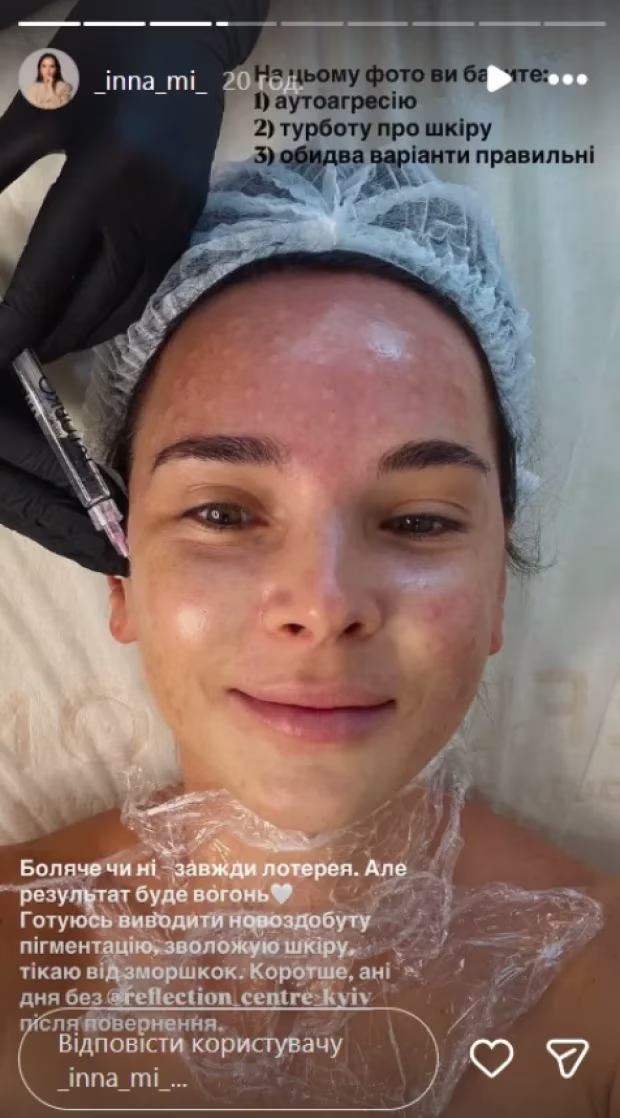 Інна Мірошниченко показує як позбутися зморшок у домашніх умовах